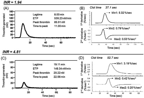 Figure 2. A comparison of thrombin generation curves measured by the CAT and aPTT-CWA transmittance curves of two different patients with two extremes of INR ranges of 1.94 and 4.50 r, respectively. (A) and (C) show the thrombin generation curves while (B) and (D) show the 1st and 2nd derivatives curves of the aPTT-based clot waveform transmittance curves. CAT: Calibrated automated thrombogram; CWA: Clot waveform analysis; ETP: Endogenous thrombin potential.