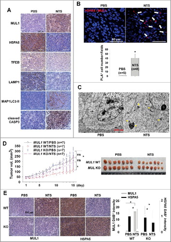 Figure 7. MUL1 KO HNC cells show resistance to NTS treatment in a xenograft in vivo model. Human FaDu (5 × 106 cells) HNC cells were injected subcutaneously into BALB/c nu/nu mice and the mice were treated with NTS every day for 14 d (PBS, n = 5; NTS, n = 8). Tumor volume and images are shown in Figure S12A. (A) Immunohistochemical analysis of HSPA5, p-AKT, MAP1LC3-II, TFEB, LAMP1, and cleaved CASP3 (scale bar: 100 μm). Protein levels were analyzed and quantified by western blot assay in Figures S12B. (B) NTS induced increases in level of the interaction between MUL1 and HSPA5 in NTS-treated mice tumors. The interaction of MUL1 and HSPA5 induced by NTS was assessed by PLA in mice tissues. Arrows indicate PLA-positive (+) cells (scale bar: 60 μm). Numbers of PLA (+) cells were counted at x200 magnification in 5 randomly chosen fields. Data are means ± SD. Asterisks indicate statistically significant differences (P < 0.05). The distribution of PLA (+) cells in whole tumor (Figure S13A) or immunostaining between HSPA5 and MUL1 (Figure S13B) is represented in Figure S13. (C) TEM of NTS-treated tumor. Arrows indicate autophagic vesicles (scale bar: 2,000 nm). (D) MUL1 knockout (KO) HNC cells showed resistance to NTS treatment. MUL1 KO cells were generated by the CRISPR/Cas9 system (Figure S14A to S14E). FaDu cells with wild-type MUL1 (WT) or MUL1 KO (each 5 × 106 cells) were injected subcutaneously into BALB/c nu/nu mice and the mice were treated with NTS every day for 15 d. Data are means ± SD. Asterisks indicate statistically significant differences (P < 0.05). (E) Immunohistochemical analysis of MUL1 or HSPA5 in tumors (scale bar: 100 μm). MUL1- or HSPA5-positive stain intensity was measured and quantified by ImageJ program. Data are means ± SD. Asterisks indicate statistically significant differences (P < 0.05).