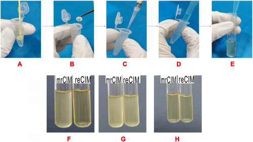 Figure 1 Procedure and results of mrCIM and reCIM. (A) Two 10-µL loopfuls of an overnight culture taken from solid media were homogenized into an Eppendorf tube containing 1mL of sterile water. (B) Two meropenem disks were added to the suspension and vortexed for 1 min. (C) For reCIM, add 10 µL of the 0.5 M EDTA to the Eppendorf tube to obtain a final concentration of 5 mM EDTA. (D) The tube was incubated for 45 min at 37°C, subsequently vortexed for an additional minute, and then centrifuged for 5 min at 10,000 rpm (for highly mucoid strains, a second centrifugation step may be needed). (E) Five hundred µL of the supernatant was added to 2500 µL of an E. coli ATCC 25922 resuspended in TSB at a 1.0 McFarland. The tubes were incubated at 37°C for 2.5 h with a nephelometer reading taken every 30 min to assess the growth of the indicator E. coli strain. For indicator E. coli growth between 1.0 and 2.0, 30mins of additional incubation was beneficial. (F) Results of mrCIM and reCIM for strain with Ambler class B metallo-β-lactamases, with OD > 2.0 for mrCIM and OD < 1.0 for reCIM. (G) Results of mrCIM and reCIM for strain with Ambler class A serine β-lactamases, with OD > 2.0 for mrCIM and OD > 2.0 for reCIM. (H) Results of mrCIM and reCIM for strain without carbapenemase, with OD < 1.0 for mrCIM and OD < 1.0 for reCIM.