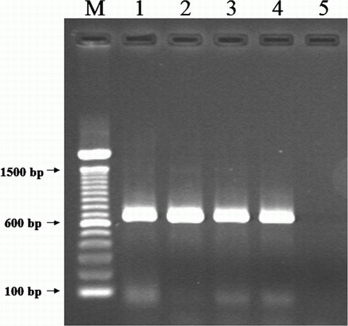 Figure 5.  Gel electrophoresis of a PCR for detection of avian poxvirus core protein 4b gene. M, 100 base pairs (bp) DNA ladder (Invitrogen, Mulgrave, Victoria, Australia); lane 1, avian poxvirus isolate from crimson rosella; lane 2, canary poxvirus; lane 3, sparrow poxvirus; lane 4, fowl poxvirus; lane 5, negative control.