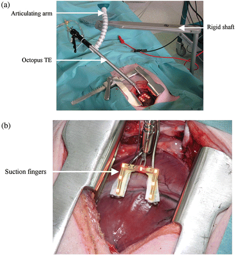 Figure 1. The setup with the Octopus TE and a close-up on the distal device. [Color version available online.]