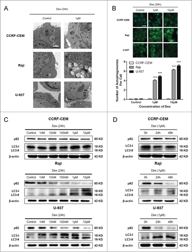 Figure 4. Dex induces autophagy in both Raji and U-937 cells. (A) CCRF-CEM, Raji, and U-937 cells were treated with 0 and 1 μM Dex for 24 h, and autophagosome formation was evaluated by transmission electron microscopy. M indicates mitochondrial structures, N the nucleus, C the cytoplasm, and arrowheads indicate autophagosomes. Scale bar: 500 nm. (B) Cells were treated with 0, 1, and 10 μM Dex for 24 h, then stained with MDC to identify autophagic vacuoles. Scale bar: 50 μm. The number of autophagosomes per cell was quantified by counting the number of autophagosomes in 100 MDC-staining cells. The data were presented as means ± SD of 3 independent experiments. (Dex vs. control: ***P < 0.001) (C) Cells were treated with increasing concentrations of Dex for 24 h, p62 and LC3 were detected by Western blot. (D) Cells were then treated with 1 μM Dex for 0, 24, and 48 h, and p62 and LC3 expression were evaluated by Western blot.