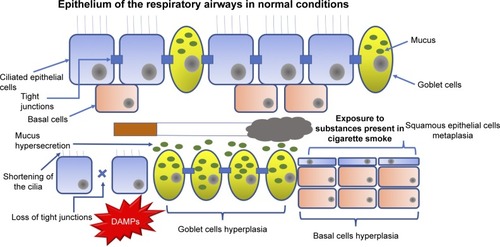 Figure 1 When airway epithelium is exposed to harmful substances, such as those contained in cigarette smoke, it changes its structure.