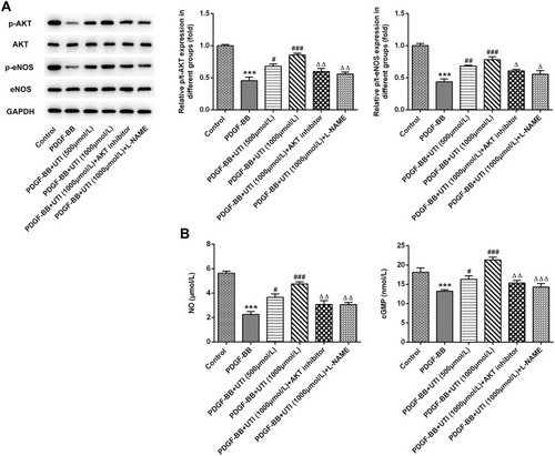 Figure 5 UTI triggers the activation of Akt/eNOS/NO/cGMP signaling pathway. (A) Western blot examined the Akt/eNOS/NO/cGMP signaling-related proteins. (B) The amount of NO and the expression of cGMP were measured by corresponding commercial kits. ***P<0.001 vs Control; #P<0.05, ##P<0.01, ###P<0.001 vs PDGF-BB; ΔP<0.05, ΔΔP<0.01, ΔΔΔP<0.001 vs PDGF-BB +UTI (1000μmol/L).