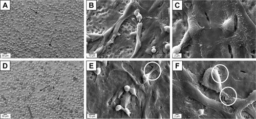 Figure 7 Representative SEM images of cell adhesion tests in cell culture.Notes: (A) UFG-A and (D) UFG-AA after 25 minutes, respectively. (B and C) UFG-A and (E and F) UFG-AA after 24 hours, respectively. The circles in images (E and F) illustrate filopodia formation on UFG-AA samples.Abbreviations: SEM, scanning electron microscopy; UFG, ultrafine grained; UFG-A, acid treated; UFG-AA, acid and alkaline treated.