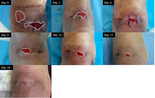 Figure 3 Representative images of the healing process in case 3.