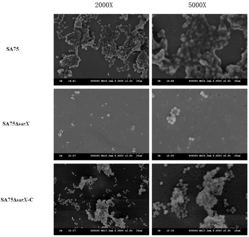 Figure 2 Scanning electron microscopy of biofilms of S. aureus SA75 and ΔsarX mutant. Transmission electron micrographs of mature biofilms of wild-type (SA75), isogenic sarX mutant (SA75ΔsarX), and chromosomally complemented (SA75ΔsarX-C) strains of S. aureus SA75. Images on the left and right were magnified 2000 (2000X) and 5000 (5000X) times, respectively.