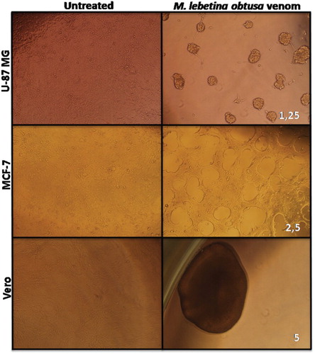 Figure 2. Macrovipera lebetina obtusa venom-induced morphological changes in U-87 MG, MCF-7 and Vero cells viewed by an inverted microscope. Cells were exposed to crude venom for 48 h. Numbers on the lower right corner of microphotographs indicate the concentration of venom used (µg/ml).