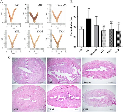 Figure 3. Effect of YK on uterus tissue of PCOS rats. (A) Uterus appearance. (B) Uterus index. (C) H&E staining images of the uterus tissues. Data are shown as mean ± SD (n = 10). Compared with the NG group, *p < .05, **p < .01, compared with the MG group, #p < .05, ##p < .01.