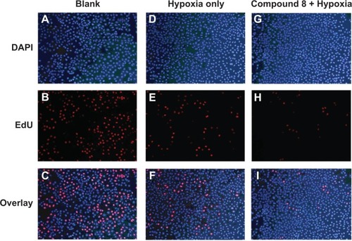 Figure 6 The fluorescent thymidine analog EdU was used to identify S-phase cells by labeling their replicating DNA (red), nuclei are colabeled with DAPI (blue).