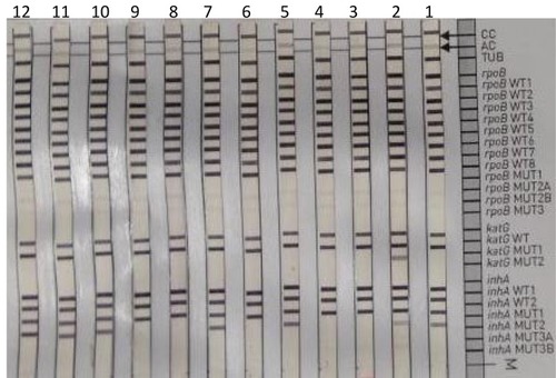 Figure 2 Banding patterns obtained by GenoType MTBDRplus VER 2.0 test. CC; conjugate control, AC; amplification control, TUB; M. tuberculosis complex-specific control, rpoB, katG and inhA; locus control zones specific for each gene. (Sample 8 is positive control of MTB (H37Rv), sample 2 have katG WT (wild type) and katG MUT1 bands which show S315T1 mutation in codon 315 of katG gene; Samples 1, 2, 5, 7, 10, 11, and 12 have inh WT1, 2 and inhA MUT1 bands which show A–16G mutation in inhA gene. Sample 2 has both KatG (S315T1) and inhA (A–16G) mutations simultaneously.