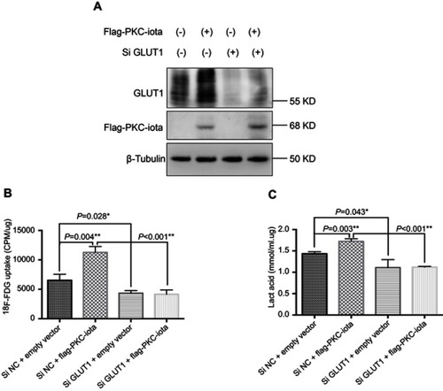 Figure 4 GLUT1 knockdown restrains PKC-iota-mediated 18F-FDG uptake and glycolysis. (A) H1650 cells were co-transfected with Flag-PKC-iota (or empty vector) and Si GLUT1 (or Si NC) for 72 h. Cell lysates were immunoblotted with antibodies against GLUT1 and Flag, whereas β-tubulin was used as the loading control. (B, C) H1650 cells were co-transfected with Flag-PKC-iota (or empty vector) and Si GLUT1 (or Si NC) for 72 h, and then intracellular 18F-FDG uptake (B) and lactification (C) were detected.