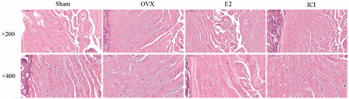 Figure 3. The sections of rat intervertebral disc tissues were stained with HE. Forty, 3-month-old female Sprague Dawley rats were randomly divided into four groups: Sham, OVX, E2 and ICI. Sham group only underwent the resection of a bit fat; OVX group underwent bilateral ovariectomy; E2 group was treated with 17β-Estradiol based on OVX; ICI group was treated with 17β-Estradiol and were also pretreated with ICI182780 (inhibitor of the estrogen receptor) based on OVX (Mean ± SD; n = 10). HE: hematoxylin and eosin; E2: 17β-Estradiol. * p < .05.