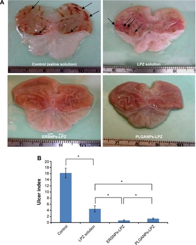 Figure 6 Photographs of stomach and ulcer index.Notes: Photographs of stomach (A) and ulcer index (B) in Wistar rats with induced ulcers after oral administration of saline solution (control), LPZ solution, ERSNPs-LPZ, and PLGANPs-LPZ (LPZ 5 mg/kg/day) for 7 days (n=4). The arrows indicate the ulcerated region. *P<0.05.Abbreviations: LPZ, lansoprazole; ERSNPs-LPZ, LPZ-loaded Eudragit® RS100 nanoparticles; PLGANPs-LPZ, LPZ-loaded poly(lactic-co-glycolic acid) nanoparticles.