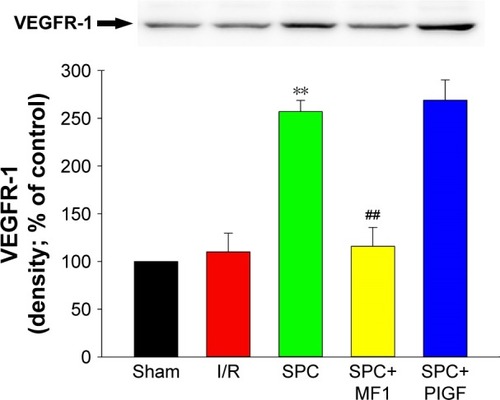 Figure 4 Representative immunoblots (top panel) of VEGFR-1 in isolated rat hearts. Values are presented as mean ± SEM.