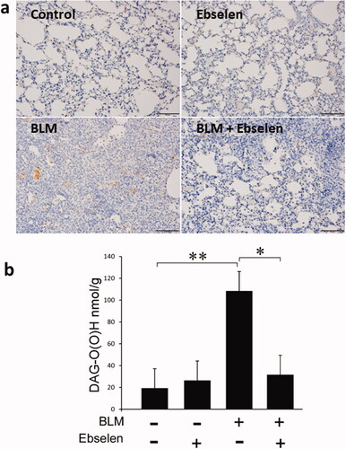 Figure 4. Inhibitory effect of ebselen on lipid peroxide. (a) Quantitative analysis of DAG-O (O) H by 4-HNE immunohistochemistry and HPLC was performed to investigate the effect of ebselen on the accumulation of lipid peroxide. There was no accumulation of 4-HNE in the control and ebselen groups. In the BLM group, 4-HNE staining was mainly observed in the alveolar epithelium, but positive cells were also observed in pulmonary interstitium; in contrast, stainability was attenuated in the BLM + ebselen group. (b) Similarly, in the measurement of oxidized DAG using HPLC, the increase induced by the administration of BLM was significantly suppressed by treatment with ebselen. P < 0.05 denotes a statistically significant difference. BLM: bleomycin; HPLC: high-performance liquid chromatography.
