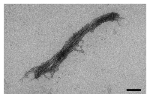 Figure 2. Transmission electron microscopy of the aggregates shown in Figure 1. Black box in the bottom-right corner corresponds to 100 nm.