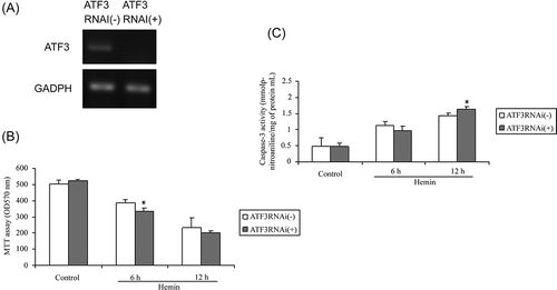 Figure 4. Effects of ATF3-siRNA on hemin toxicity in HK-2 cells. (A) ATF3-siRNA reduced ATF3 gene expression. (B) ATF3-siRNA reduced cell viability after 75 μmol/L hemin treatment for 6 h. (C) ATF3-siRNA augmented caspase-3 activity after 75 μmol/L hemin treatment for 12 h. Each value is expressed as mean ± SD. *p < 0.05 compared to control siRNA-treated group.