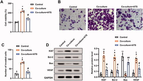 Figure 2. Impact of asiaticoside on the growth and invasion of osteosarcoma cells induced by M2 phenotype macrophages. M2 phenotype macrophages induced by IL-4/IL-13 were co-cultured with osteosarcoma cells, and the cells were treated with 40 μM ATS for 24 h. (A) The viability of U2OS cells was analyzed using a CCK-8 assay. (B) The invasion of U2OS cells was assessed by Transwell assay (magnification:200). (C) The quantitative results of cell invasion. (D) The protein levels of Ki-67, Bcl-2, Bax, and vascular endothelial growth factor (VEGF) were measured using Western blot. *p < 0.05, **p < 0.01 vs. control. #p < 0.05, ##p < 0.01 vs. co-culture. Each assay was conducted in triplicate.