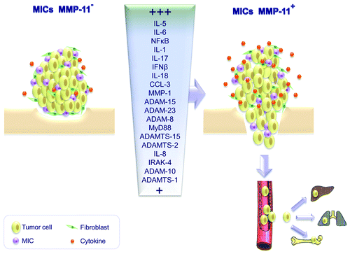 Figure 1. Effects of matrix metalloprotease 11 (MMP-11) expression by mononuclear inflammatory cells on the cytokine profile and metastatic potential of breast cancer. Tumors infiltrated by mononuclear inflammatory cells (MICs) that do not express MMP-11 release less pro-inflammatory factors than tumors containing MMP-11+ MICs. These latter cells mainly express interleukin (IL)-1, IL-5, IL-6, IL-17, interferon β (IFNβ) and NFκB and are associated with poor prognosis. MMP-11 expression by MICs coupled to the upregulation of pro-inflammatory proteins appears indeed to promote the metastatic spread of breast carcinoma cells.