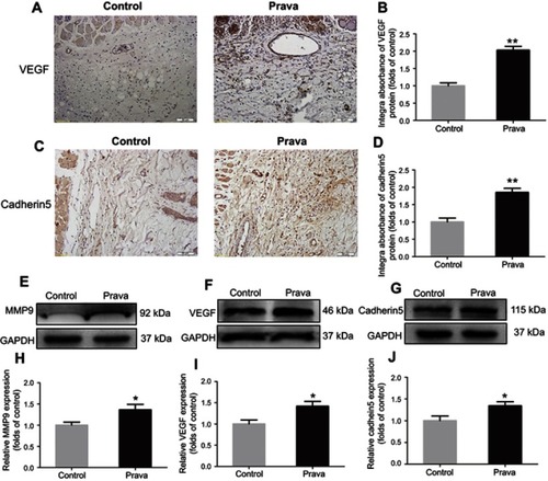 Figure 3 Prava promoted angiogenesis in skin flap. (A) IHC of VEGF expression in vessels and stromal cells in ischemic skin flaps (area II) (original magnification, ×200; scan bar, 50 μm). (B) Histogram of integral absorbance of VEGF protein. (C) IHC of Cadherin5 expression in vascular endothelial and stromal cells in skin flaps (original magnification, ×200; scan bar, 50 μm). (D) Histogram of integral absorbance of Cadherin5 protein. (E–G) Western blotting analysis of MMP9, VEGF, and Cadherin5 expression, with GAPDH as an internal control. (H–J) Histogram of optical density values of MMP9, VEGF ,and Cadherin5 expression. (Significance: *p<0.05 and **p<0.01 vs the Control group. Data were shown as means±SEM. n=6 per group).Abbreviations: MMP9, matrix metallopeptidase 9; VEGF, vascular endothelial growth factor; IHC, immunohistochemistry; Prava, pravastatin; SEM, standard error of the mean.