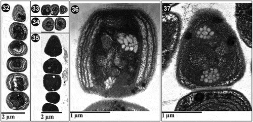 Figs 32–37. Ultrastructure of Pseudanabaena pruinosa. Fig. 32. P. pruinosa NMCCC 001. The parietal organization of 5–8 thylakoid membranes can be observed, as well as the position of polar aerotopes. Fig. 33. Central aerotopes in P. pruinosa NMCCC 001. Fig. 34. Cell shape and ultrastructure of P. pruinosa NMCCC 002. Fig. 35. P. pruinosa NMCCC 013. The parietal organization of thylakoids and the presence of a central aerotope can be observed. Fig. 36. Polar and central aerotopes in P. pruinosa NMCCC 013. Fig. 37. Aerotopes with irregular position within the cell of P. pruinosa NMCCC 014. Scale bar = 10 µm.