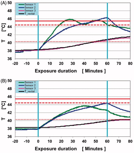 Figure 6. Sensor temperatures for pig 12 (A) and 6 (B) versus time, during RF irradiation in the MR body coil, for sensors 1 (green line), 2 (blue line), 3 (purple line), and R (rectal, black line). Two lower thresholds are displayed as horizontal red lines: T-low = 45.5 °C for sensor1 (solid line), T-low = 44.4 °C for sensor 2 (dashed line). Also, the lower damage-related value T-low = 40.3 °C for sensor 3 (dotted line) is displayed. The time scales on the abscissa axes are arranged so that the start and the end of the RF irradiation are at 0 and 60 min, respectively (both values are marked by light blue vertical lines). Note that temperatures for sensors 3 and R (rectal) are almost identical.