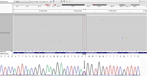 Figure 3 NGS data identifying the APP p.V604M mutation in the proband.