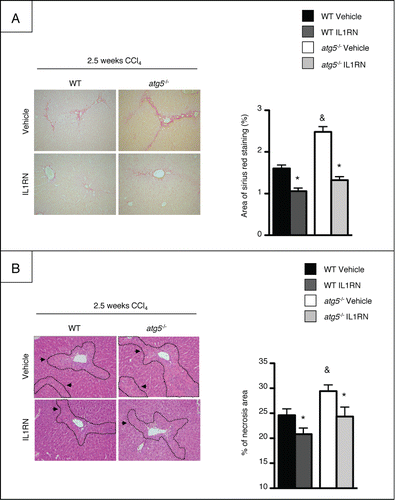 Figure 7. Treatment with recombinant IL1RN rescues atg5−/− mice from CCl4-induced liver fibrosis and injury. Mice were exposed to CCl4 and treated with recombinant IL1RN or its vehicle for 2.5 wk (A) Left, representative liver tissue sections stained with Sirius Red (original magnification x200). Right, quantification of fibrosis area by morphometry. (B) Left, representative staining of liver tissue sections stained with hematoxylin and eosin (original magnification x200). Arrows indicate necrotic areas. Right, quantification of necrosis area by morphometry. *, p < 0.05 for IL1RN vs vehicle and &, p < 0.05 for atg5−/− vs WT. n = 7 for WT vehicle, n = 6 for atg5−/− vehicle, n = 4 for WT IL1RN and n = 5 for atg5−/− IL1RN.