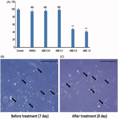 Figure 1. The cell viability assay in HSC-T6 and morphological changes in primary HSCs on treatment with ABE. (A) HSC-T6 cells were incubated with ABE at indicated concentrations for 24 h and the cell viability was determined by MTT assay. (B) Primary HSCs were cultivated for 1 week and exposed to the ABE 0.1 mg/mL for 24 h. Pictures were taken after 24 h treatment with ABE. Magnification was 100X. Arrows indicate HSCs. The data are expressed as means ± SEM (n = 6), using one-way analysis of variance (ANOVA) followed by Student’s t-test. ***p < 0.001, compared with control group. NS: Not significant compared with control group.