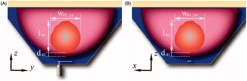Figure 3. Schematic representation of the breast comprising the treatment volume (41 °C iso-therm volume), distance from the skin to the treatment volume, d41, width of the treatment volume in the plane yz, w41_yz, width of the treatment volume in the plane xz, w41_xz, and length of the treatment volume l41.