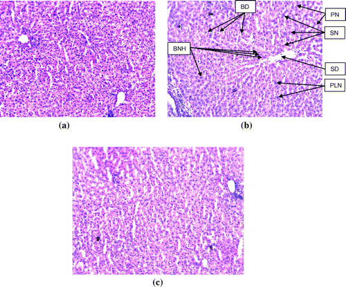 Figure 1. Rat liver sections stained with haematoxylin-eosin (200× magnification) (a) control; (b) rats exposed to NDEA (0.1 mg/ml) for 21 days, and (c) rats exposed to 0.1 mg/ml of NDEA along with 15 mg/ml of epigallocatechin gallate.