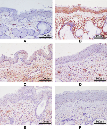 Figure 12 The effect of FFZJF aerosol on the MyD88 protein expression in rat’s pharyngeal mucosal tissues by immunohistochemistry (400×). MyD88 is stained brown. (A) Control group; (B) Model group; (C) FFZJF-L group; (D) FFZJF-M group; (E) FFZJF-H group; (F) AS group.