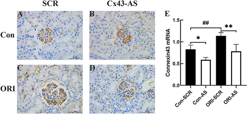 Figure 1 Cx43 AS downregulated Cx43 expression of glomeruli in control and ORI mice respectively. (A–D) Representative image of kidney stained with IHC for Cx43. Standard bar = 50µm. (E) The expression level of Cx43 mRNA in glomeruli at the 4th week after osmotic pump implantation of Cx43 antisense oligodeoxynucleotide (AS) or scrambled oligodeoxynucleotide (SCR). Data represent mean ± SEM (n=12 per group), and one-way ANOVA with LSD-t multiple comparison test was performed; ##P < 0.01, Con-SCR vs ORI-SCR. *P < 0.05, **P< 0.01, ORI-SCR vs ORI-AS or Con-SCR vs Con-AS.