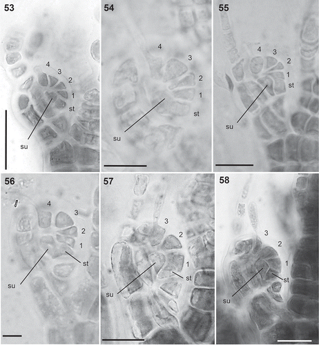 Figs 53–58. Carpogonial branches in the Polysiphonieae. Four-celled in Polysiphonia stricta (Fig. 53, Polysiphonia sensu stricto clade 1), P. nigra (Fig. 54, Vertebrata clade), P. denudata (Fig. 55, Carradoriella clade) and P. schneideri (Fig. 56, ‘P.’ schneideri clade). Three-celled in species of the Melanothamnus clade: Neosiphonia harveyi (Fig. 57) and P. blandii (Fig. 58). Su = supporting cell; st = sterile basal cell; 1–4 cells of carpogonial branches. Scale bars: Fig. 53, 30 µm; Figs 54–58, 20 µm.