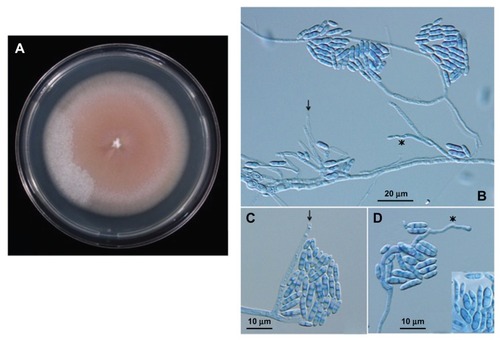 Figure 3 Morphological findings of the isolate. (A) Colony incubated on potato dextrose agar at 25°C for 13 days. (B, C, D) Microscopic findings on slide cultures grown on potato dextrose agar. Phialides arise from conidiophore apices or hyphae as side branches. They are straight or twisted (asterisks), tapering toward the tops, with an open end and collarette (arrows). Phialoconidia are cylindrical with pointed ends, or narrow spindle-shaped, straight, or slightly curved, and mostly uniseptate. Lactophenol cotton blue stain. (B) ×400; (C and D), and inset ×600.