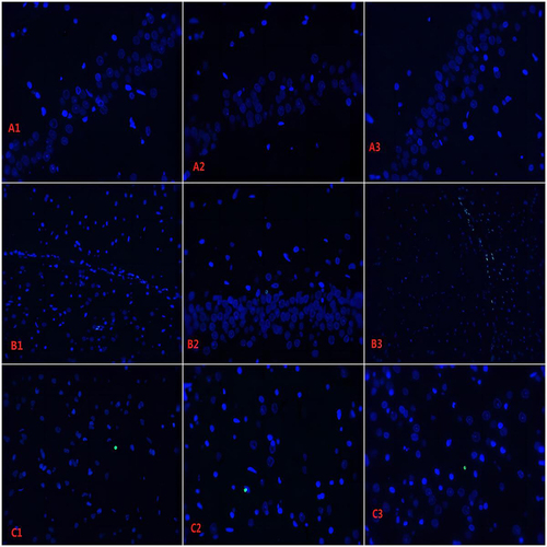 Figure 9 Comparison of TUNEL detection in the hippocampus of rats in each group (TUNEL staining, x 400). A1:CON1, A2: CON7, A3:CON28, no obvious apoptosis was observed. B1:aMCI1, B2: aMCI7, B3: aMCI28, a large number of apoptotic cells were observed. C1:HBO1, C2: HBO7, C3: HBO28, a small number of apoptotic cells were scattered.