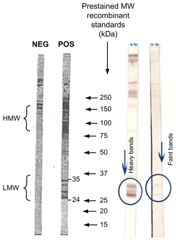 Figure 1 Western blot-specific IgG anti-Toxocara canis. Low molecular weight zone is Toxocara-specific. The presence on the strip of two or more low molecular weight bands in the range of 24–35 kDa is indicative of the presence of specific anti- Toxocara IgG in the sample.
