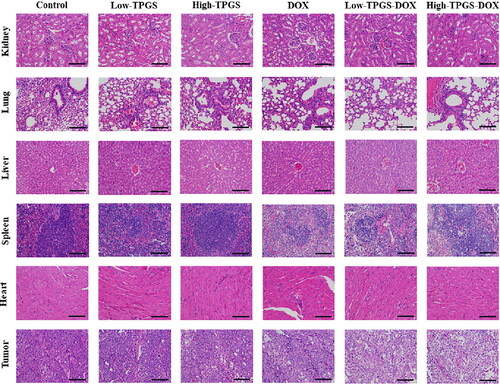 Figure 5. Tissue histology sections from different TPGS treatments. Hematoxylin & Eosin stained tissue images (tumor, heart, liver, spleen, lung, and kidney) of MCF-7-ADR tumor-bearing nude mouse groups. Bars represent 200 µm.