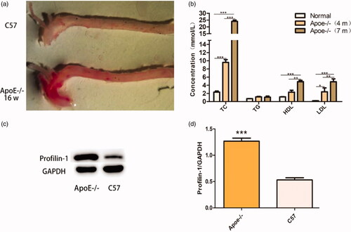 Figure 4. The established atherosclerosis model. (a) C57BL/6 (normal control; upper panel) and established atherosclerosis model (lower panel). (b) Serum lipid profile of the atherosclerosis model. (c,d) Evaluation of profilin-1 expression in the atherosclerosis model and C57BL/6 using western blotting (*p < .05, **p < .01, ***p < .001).