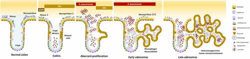 Figure 9. Schematic representation of a hypothesized process of ST11 K. pneumoniae-promoted tumorigenesis in an AOM-DSS-induced colitis model. Accumulation of the AOM-induced DNA mutations caused the transition of a small portion of colonocytes into the tumorigenic state. Recurrent episodes of DSS-generated inflammation reduced the production of mucus and the abundance of mucus-associated Mucispirillum, and elicited crypt abscesses (neutrophils accumulation in the lumen of crypt). Under this circumstances, ST11 K. pneumoniae expansion promoted the accumulation of CD163+ macrophages inside the crypt lumen. Through the massive production of IL-10 by these macrophages, the surroundings of the crypts became immunosuppressive areas, which help the evasion of ST11 K. pneumoniae from the host immunity. On the other hand, it allowed the aberrant growth of tumor cells, contributing to the early-to-late transition of colorectal adenomas