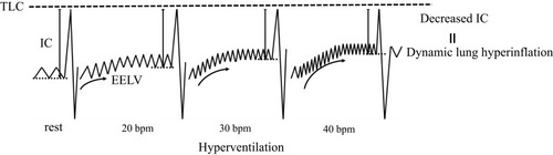 Figure 1 Metronome-paced incremental hyperventilation (MPIH) method in dynamic lung hyperinflation measurement.