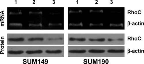 Figure 1 Anti-RhoC siRNA inhibits RhoC mRNA levels and protein synthesis.