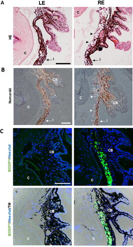 Figure 10. Detection of microspheres in injected eyes. A. Paraffin sections stained with Hematoxylin/Eosin exhibited the presence of the microspheres integrated into the iridocorneal angle (arrowheads), a finding never observed in the control ones. B. The characteristic light diffraction produced by microspheres using Nomarski microscopy (arrowheads) confirmed their presence in the iridocorneal angle of injected eyes. C. The Fluorescent Stain BODIPY (green) also showed the presence of microspheres hampering the iridocorneal angle and the trabecular meshwork. Nuclei were counterstained with Hoechst (blue). LE: left eye (non-intervened); RE: Right eye (dexamethasone-fibronectin microsphere injected). CB: Ciliary body; I: Iris; C: cornea; TM: Transmission mode. Scale bars: 100 µm.