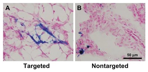 Figure 9 Prussian blue staining images of tumor tissues from mice after injection of (A) targeted Bt-ML and (B) nontargeted ML.Abbreviations: Bt-ML, biotinylated magnetoliposomes; ML, magnetoliposomes.