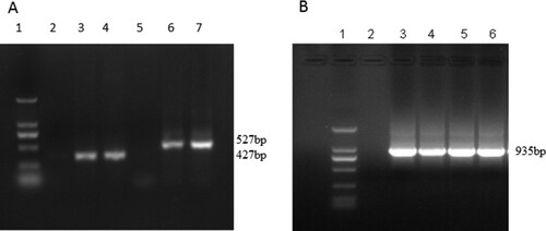 Figure 1. Analysis of amplified VH, VL and SOE-PCR products by agarose gel electrophoresis. (A) 1:DNA ladder, from top to bottom, 2000,1000,750, 500, 250, 100 bp; 3–4:VL (Tomlinson I); 6:VH (B10); 7: VH (F2). (B) 1: DNA ladder, from top to bottom, 2000, 1000, 750, 500, 250, 100 bp 3: VL (Tomlinson I)-VH (B10); 4: VL (Tomlinson I)-VH (F2); 5: VL (B10)-VH (Tomlinson I); 6: VL (F2)-VH (Tomlinson).