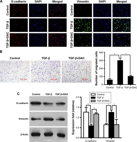 Figure 3 DAC inhibits TGF-β1-induced EMT in PC9.