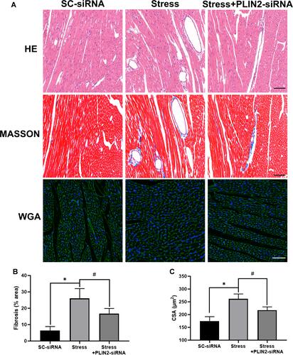 Figure 9 PLIN2 knock down ameliorates myocardial pathohistological alteration in stressed rats. The representative image of hematoxylin-eosin (HE) staining (the upper panel), Masson-trichrome staining (the middle panel) and WGA staining (the lower panel) of left ventricular tissue of heart. (A) Scale bar = 50 μm. The quantification analysis of fibrosis area (B) and cross section area (C) show PLIN-siRNA attenuates myocardial fibrosis and hypertrophy in stressed rats. Data are presented as the mean ± SD. n = 6–8, *p < 0.05, #p < 0.05, t-test.