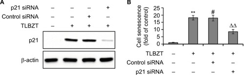 Figure 1 Role of p21 in TLBZT-induced cell senescence.