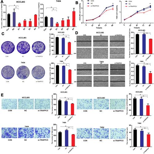 Figure 3 TRAPPC5 knockdown inhibited HCC cell proliferation, migration, and invasion. (A) The down-regulation effect of four siRNAs (S1-4) in two HCC cell lines (HCCLM3 and BEL-7404) were tested by qPCR and S1 was selected for further research. (B, C) TRAPPC5 downregulation significantly inhibited HCC cell proliferation as analyzed by CCK-8 assay and colony formation. (D, E) TRAPPC5 downregulation also suppressed HCC cell invasion and migration by wound healing assay and transwell assay. *P < 0.05.